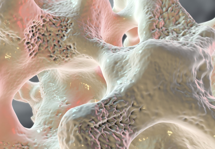 Spongy bone tissue affected by osteoporosis, 3D illustration