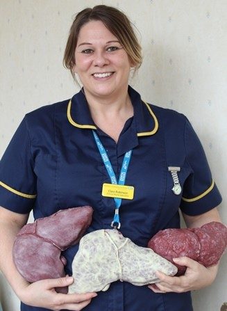 A female nurse in a blue uniform is holding three plastic livers in her hands