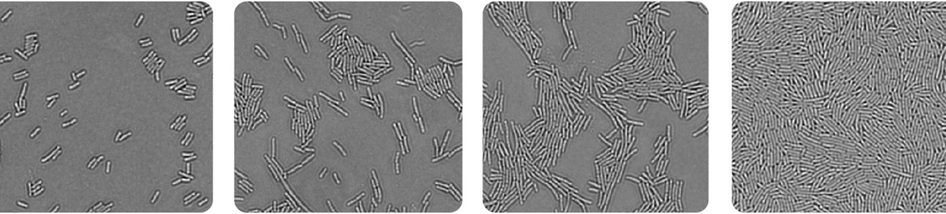 An image of growing bacteria under a microscopy.