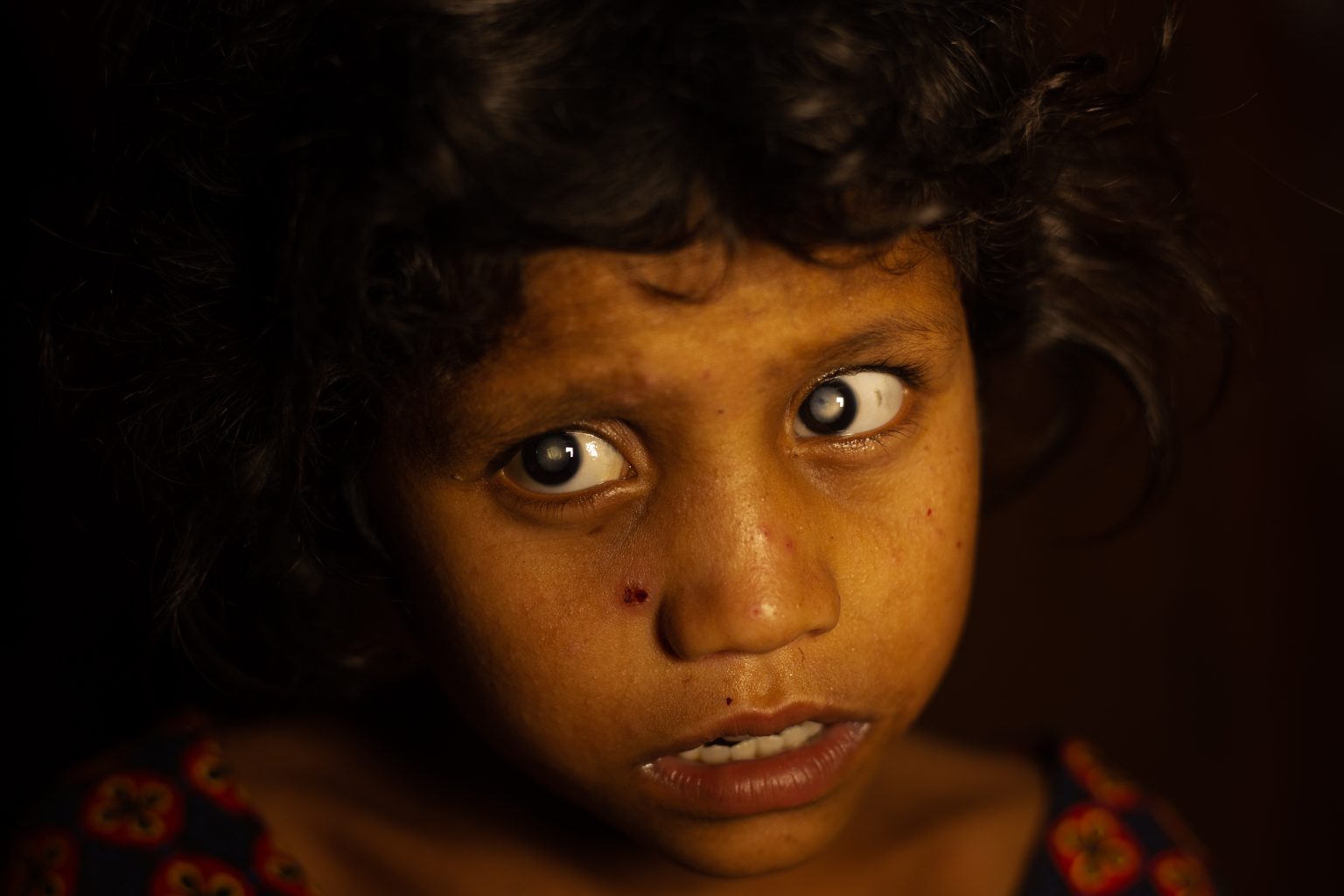 New Documentary Short Shows Why Early Intervention On Childhood Blindness Is Key To Preventing Extreme Poverty
