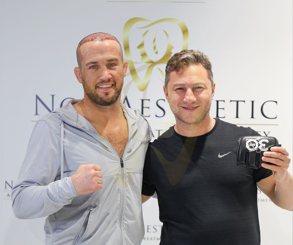 Turkey is Preferred for Hair Transplantation from Europe, America and Canada