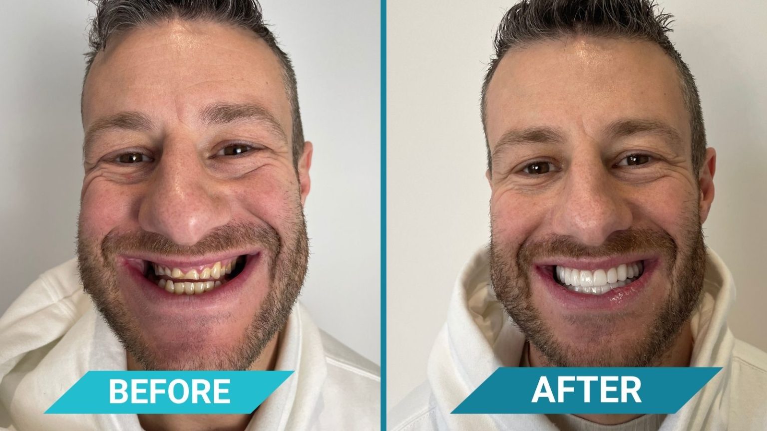 CLINIQUEPLUS Leads the Charge in Revolutionary Dental Treatments CLINIQUEPLUS Leads the Charge in Revolutionary Dental Treatments