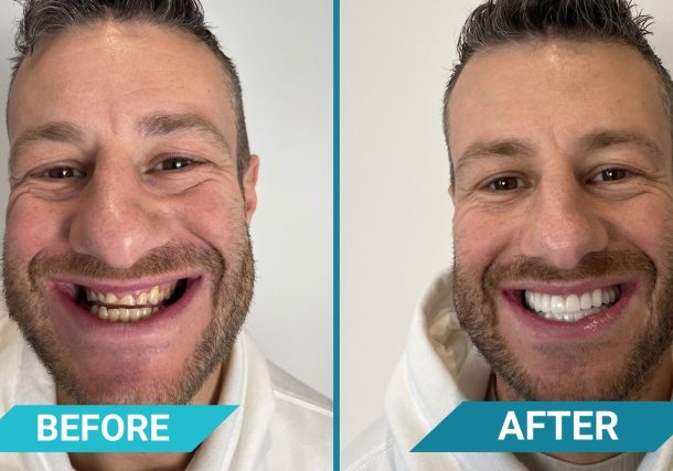 CLINIQUEPLUS Leads the Charge in Revolutionary Dental Treatments