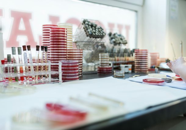 Professor Pierluigi Rossi Ferrini: A Pioneer in Hematology and Fundraising for Medical Research