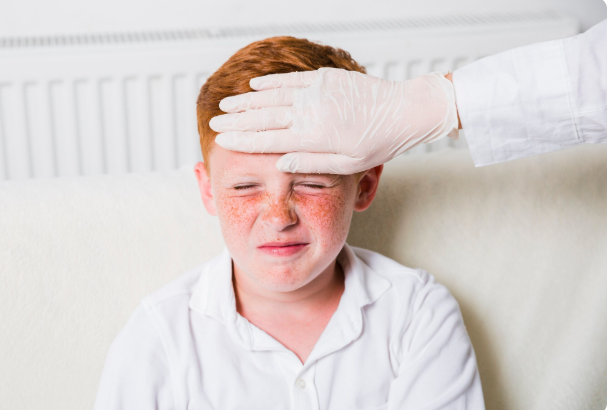 UK Meningitis Outbreak in Kent Has Killed Two Students — and a New Report Says 159 People Died in Britain Last Year Alone UK Meningitis Outbreak